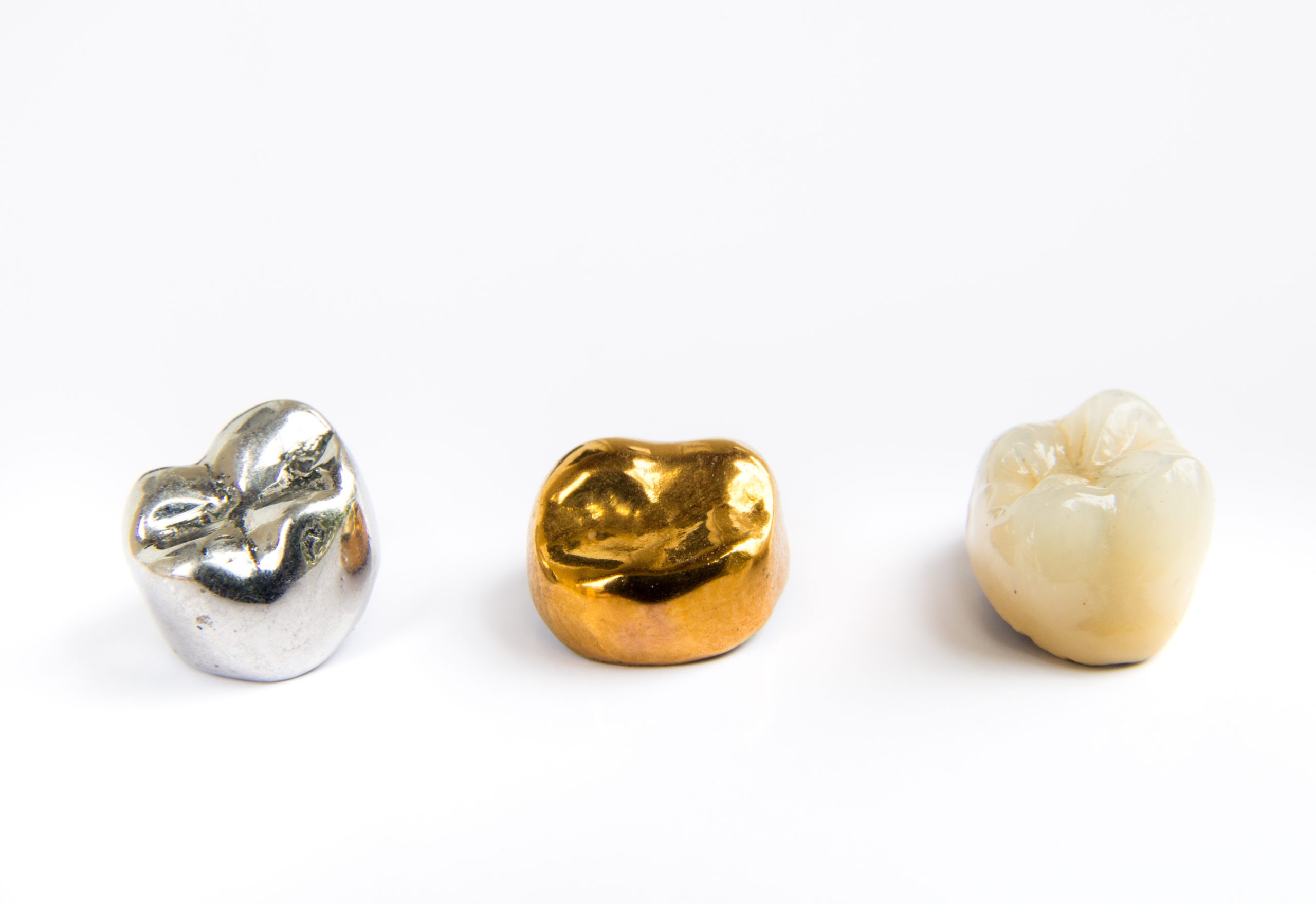 Are permanent gold teeth better than temporary?